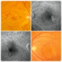 NICE RETINA logo