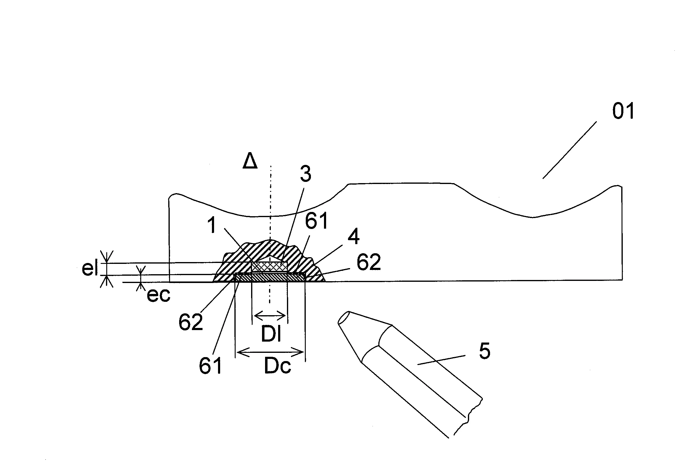 Procede d'integration d'un composant rfid dans un substitut de prothese ou d'implant ou dans un instrument chirurgical en polymere ou en plastique