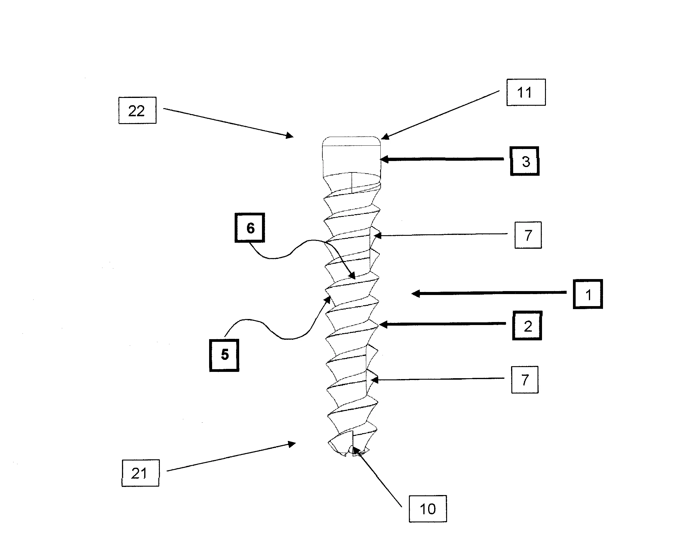 Prothese d'osteosynthese destinee a la reduction des fractures non deplacees