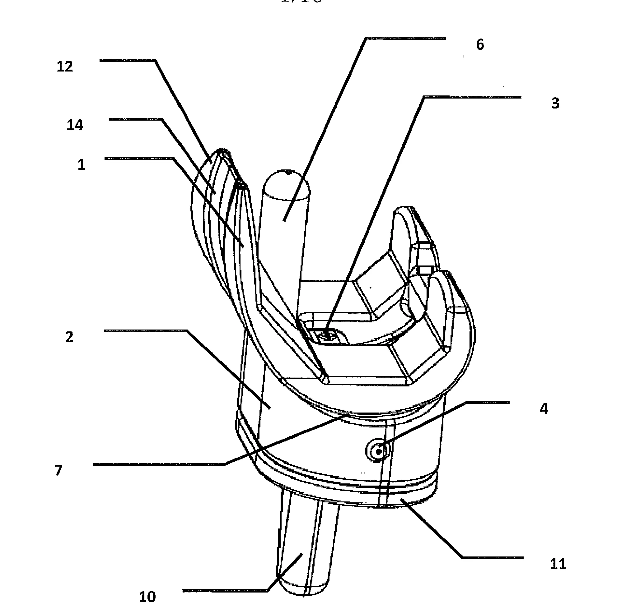 Implant espaceur de remplacement temporaire d'une prothese de genou