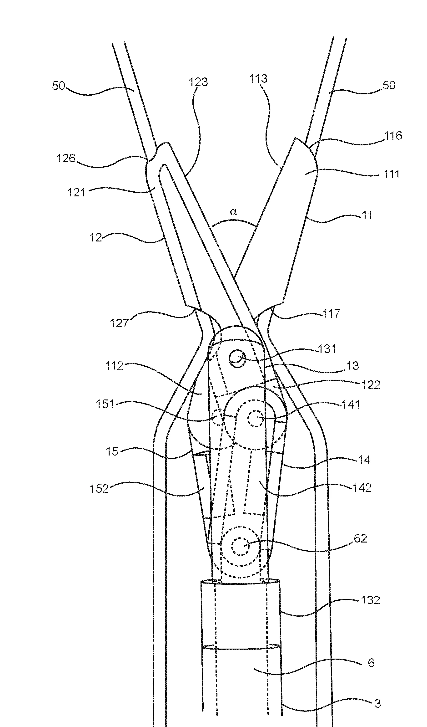 Dispositif de decoupe pour chirurgie endovasculaire.