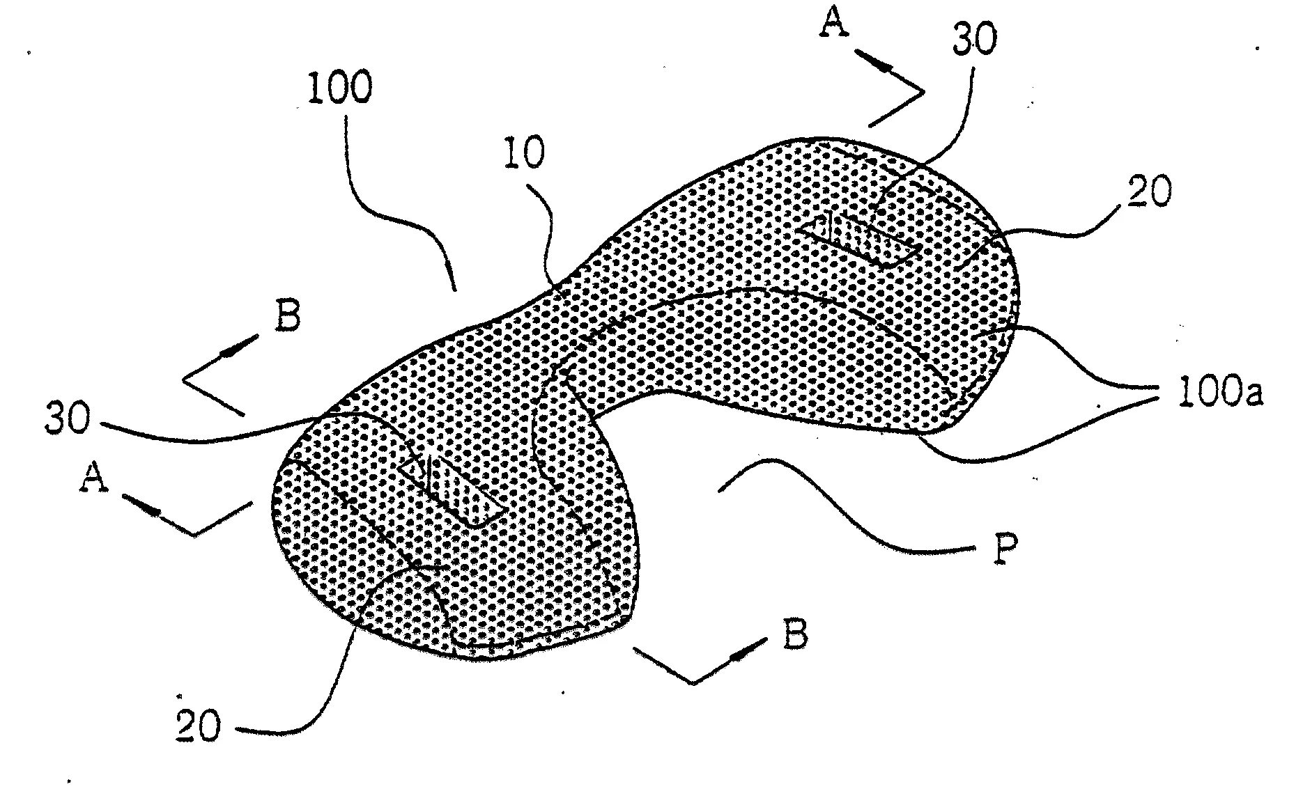 Coussin cervical anti-phlebites