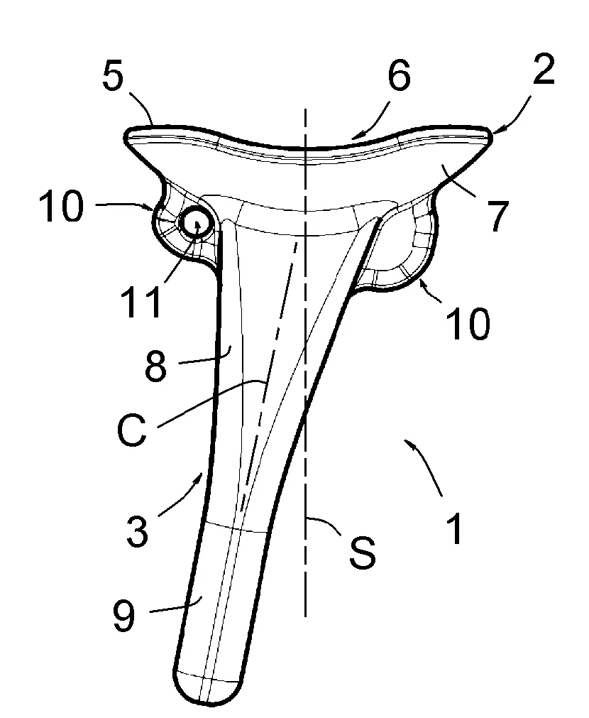 Prothese de resurfacage du radius distal