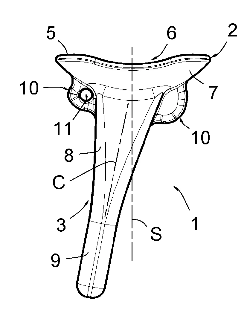 Implant de resurfacage du radius distal